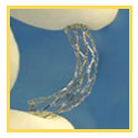 Coronary Stents